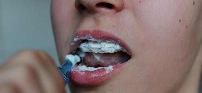 Negative opplevingar i barndommen kan føre til dårlegare tannhelse. Illustrasjonsfoto: Frank May / NTB / NPK