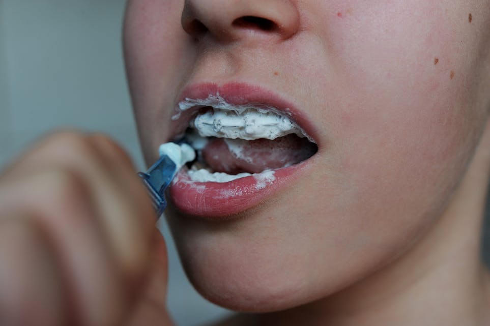 Negative opplevingar i barndommen kan føre til dårlegare tannhelse. Illustrasjonsfoto: Frank May / NTB / NPK